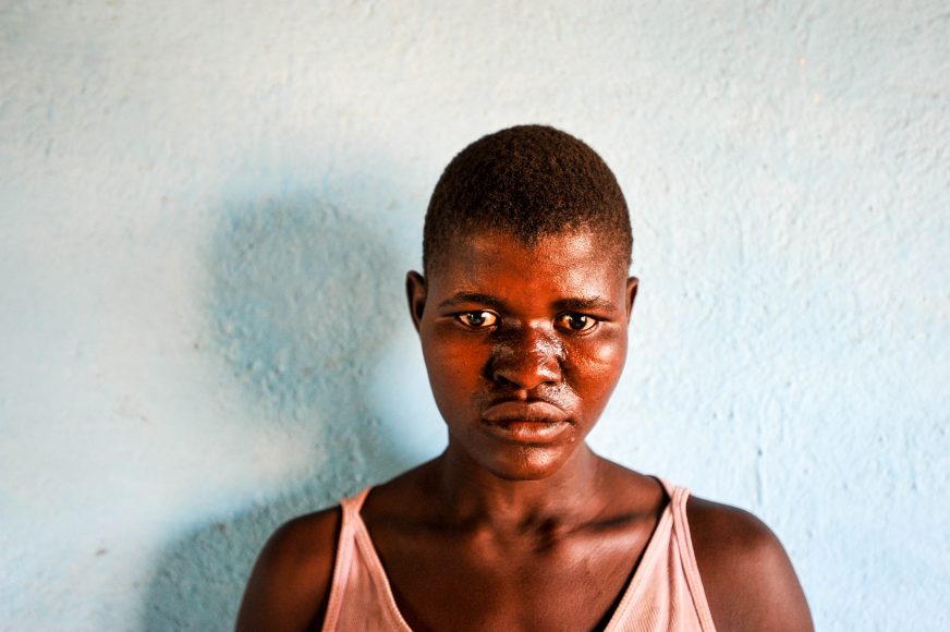 Ntoya Sande is 15 and lives in Kachaso village, Nsanje district, Malawi. She was married at 13 to Sande Chimkangu, who was 19 at the time. They have a one year old daughter, Silika Sande. He paid her parents MWK 25,000 ($34) and 50 kg of sugar.  Their crops were destroyed by the flooding which swamped the district in 2015.